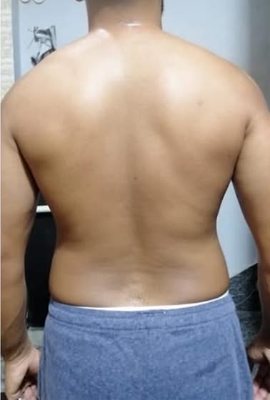 ضهر عميل قبل المتابعة